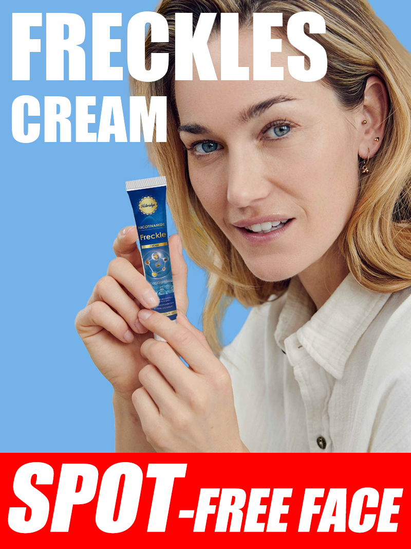 Luxury Skincare Cream - Donkere Vlekken Corrigerende Crème voor het